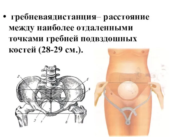 гребневаядистанция– расстояние между наиболее отдаленными точками гребней подвздошных костей (28-29 см.).