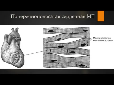 Поперечнополосатая сердечная МТ