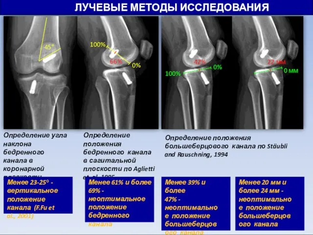 ЛУЧЕВЫЕ МЕТОДЫ ИССЛЕДОВАНИЯ 45° 100% 66% 0% 100% 42% 0% 22 мм