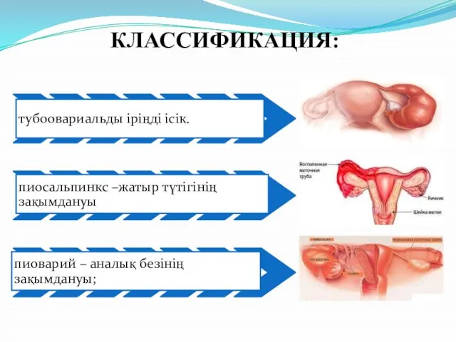 КЛАССИФИКАЦИЯ: