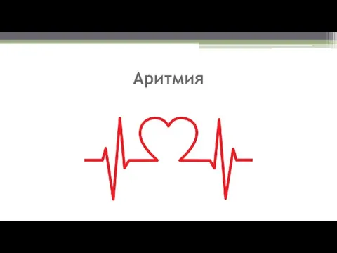 Аритмия