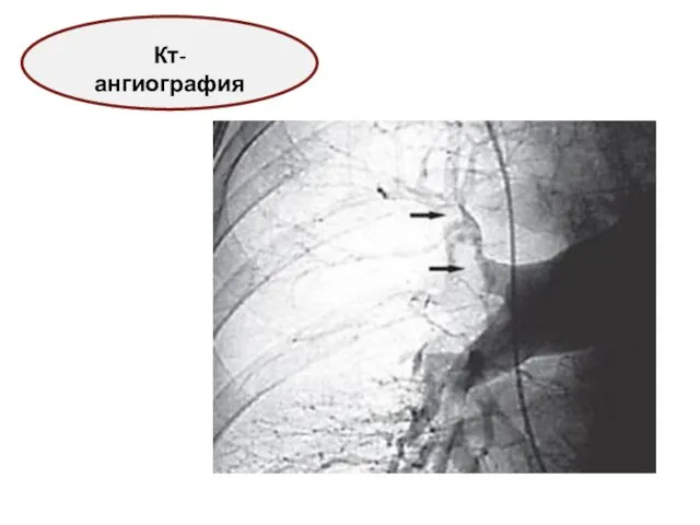 Кт-ангиография