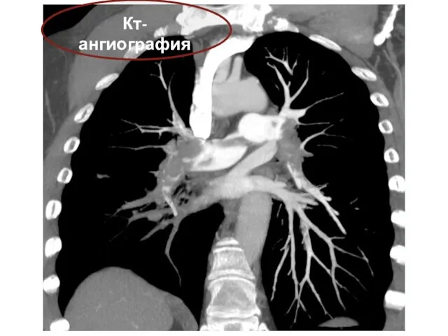 Кт-ангиография