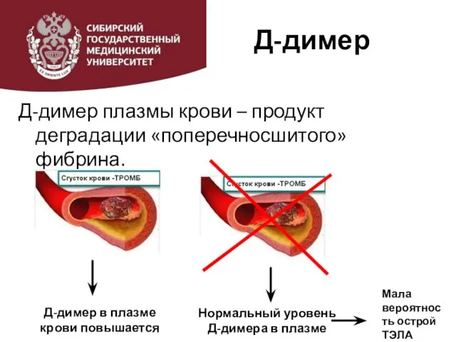 Д-димер Д-димер плазмы крови – продукт деградации «поперечносшитого» фибрина. Д-димер в плазме