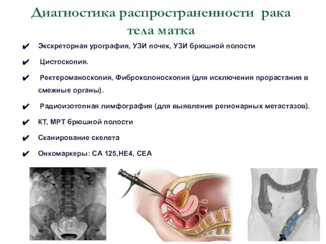 Экскреторная урография, УЗИ почек, УЗИ брюшной полости Цистоскопия. Ректероманоскопия, Фиброколоноскопия (для исключения