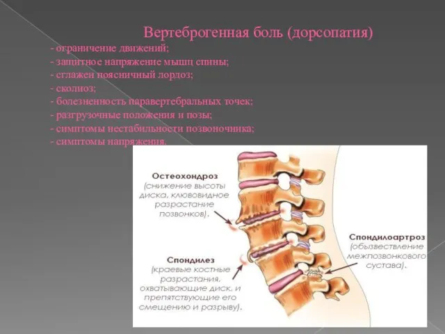 Вертеброгенная боль (дорсопатия) - ограничение движений; - защитное напряжение мышц спины; -