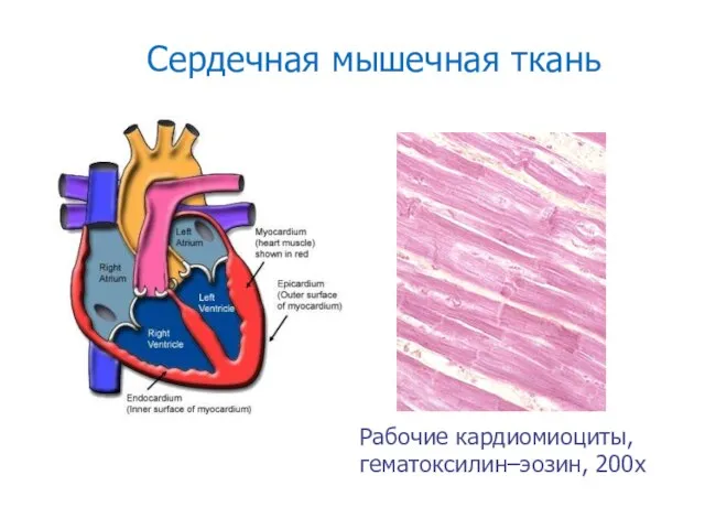 Сердечная мышечная ткань Рабочие кардиомиоциты, гематоксилин–эозин, 200х