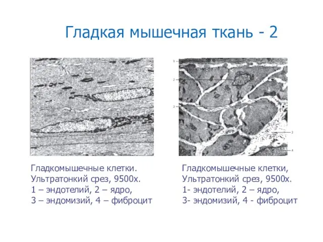 Гладкая мышечная ткань - 2 Гладкомышечные клетки, Ультратонкий срез, 9500х. 1- эндотелий,