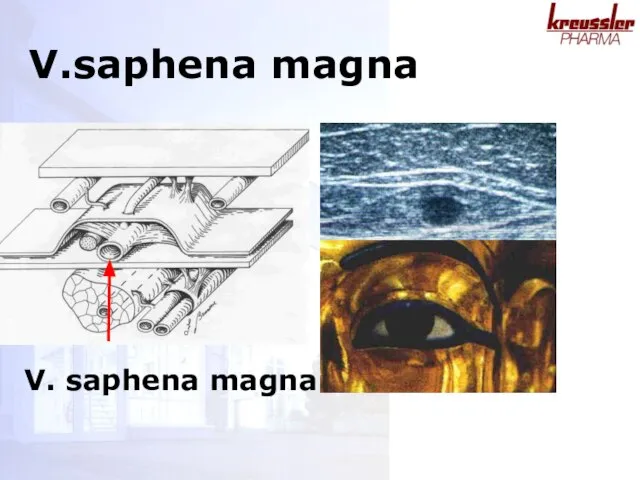V. saphena magna V.saphena magna