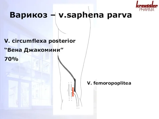 V. circumflexa posterior “Вена Джакомини” 70% V. femoropoplitea Варикоз – v.saphena parva