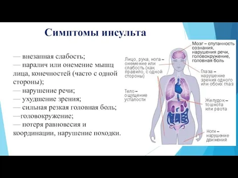 Симптомы инсульта — внезапная слабость; — паралич или онемение мышц лица, конечностей