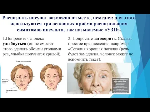 Распознать инсульт возможно на месте, немедля; для этого используются три основных приёма