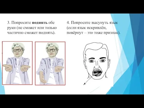 3. Попросите поднять обе руки (не сможет или только частично сможет поднять).