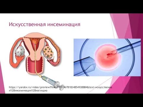 Искусственная инсеминация https://yandex.ru/video/preview?filmId=13196781834854938884&text=искусственная%2Bинсеминация%2Bнаглядно