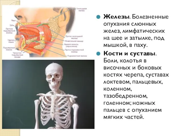 Железы. Болезненные опухания слюнных желез, лимфатических на шее и затылке, под мышкой,