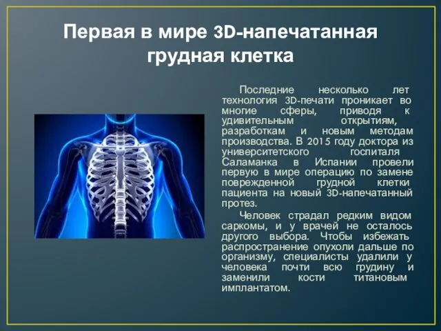 Первая в мире 3D-напечатанная грудная клетка Последние несколько лет технология 3D-печати проникает