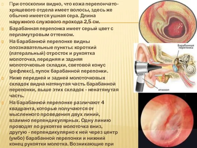 При отоскопии видно, что кожа перепончато-хрящевого отдела имеет волосы, здесь же обычно