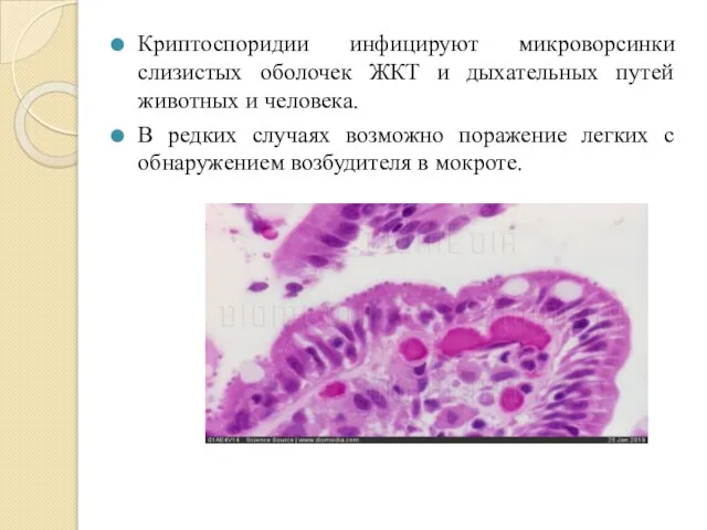 Криптоспоридии инфицируют микроворсинки слизистых оболочек ЖКТ и дыхательных путей животных и человека.