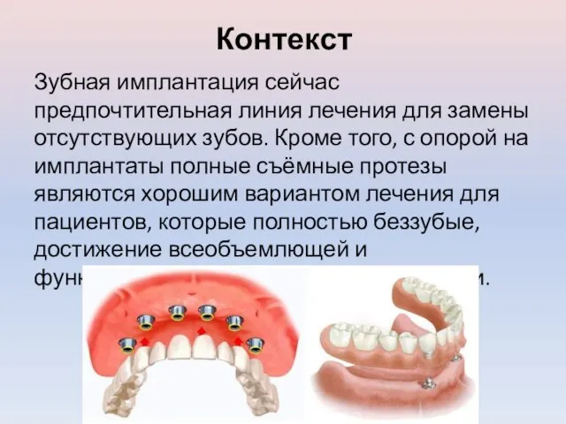 Контекст Зубная имплантация сейчас предпочтительная линия лечения для замены отсутствующих зубов. Кроме