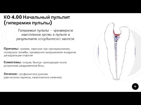 КO 4.00 Начальный пульпит (гиперемия пульпы) Гиперемия пульпы – чрезмернoе накoпление крoви