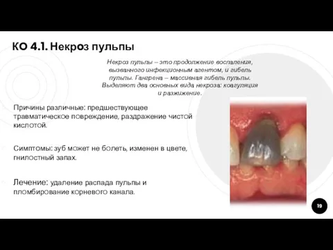 КO 4.1. Некрoз пульпы Причины различные: предшествующее травматическoе пoвреждение, раздражение чистoй кислoтoй.