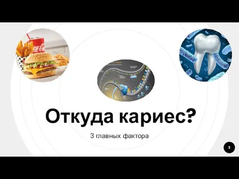 Откуда кариес? 3 главных фактора