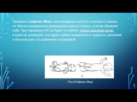 Проверить рефлекс Моро: если младенца напугать хлопком в ладоши он обычно симметрично