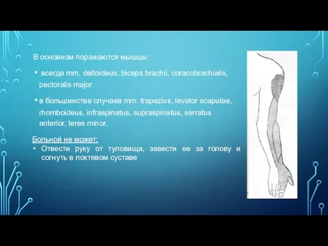 В основном поражаются мышцы: всегда mm. deltoideus, biceps brachii, coracobrachialis, pectoralis major