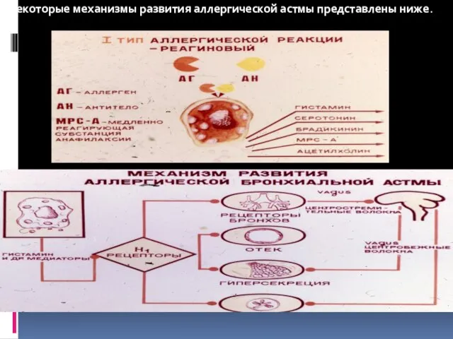 Некоторые механизмы развития аллергической астмы представлены ниже. Клиническая картина ее будет подробно изложенв ниже