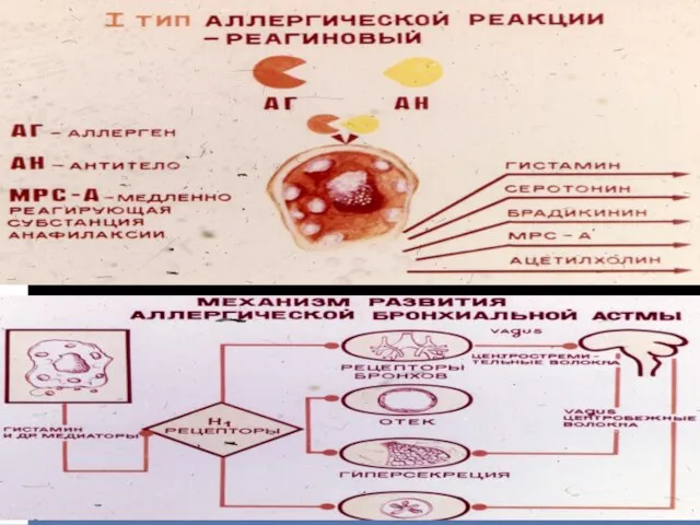 МехРеагАстмы