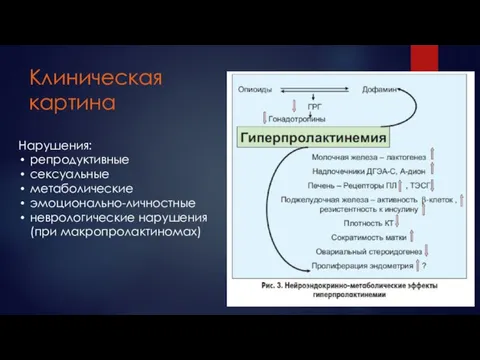 Клиническая картина Нарушения: репродуктивные сексуальные метаболические эмоционально-личностные неврологические нарушения (при макропролактиномах)