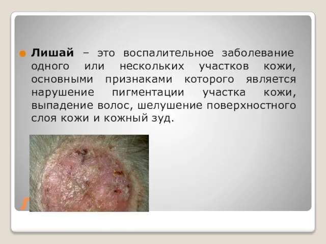 Лишай Лишай – это воспалительное заболевание одного или нескольких участков кожи, основными