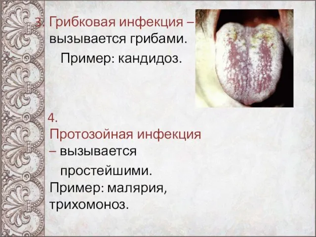 3. Грибковая инфекция – вызывается грибами. Пример: кандидоз. 4. Протозойная инфекция –