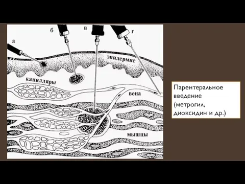 Парентеральное введение (метрогил, диоксидин и др.)