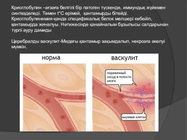 Криоглобулин –ағзаға белгілі бір патоген түскенде, иммундық жүйемен синтезделеді. Төмен t°C ерімей,