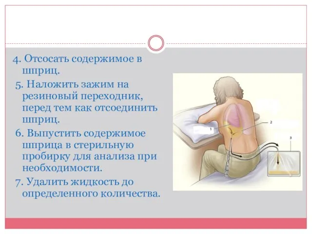 4. Отсосать содержимое в шприц. 5. Наложить зажим на резиновый переходник, перед