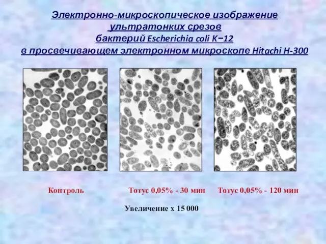 Электронно-микроскопическое изображение ультратонких срезов бактерий Escherichia coli K−12 в просвечивающем электронном микроскопе