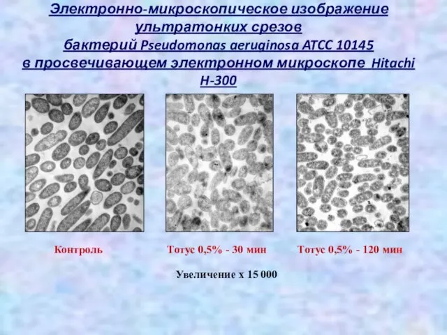 Электронно-микроскопическое изображение ультратонких срезов бактерий Pseudomonas aeruginosa ATCC 10145 в просвечивающем электронном