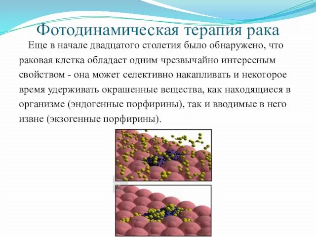 Фотодинамическая терапия рака Еще в начале двадцатого столетия было обнаружено, что раковая