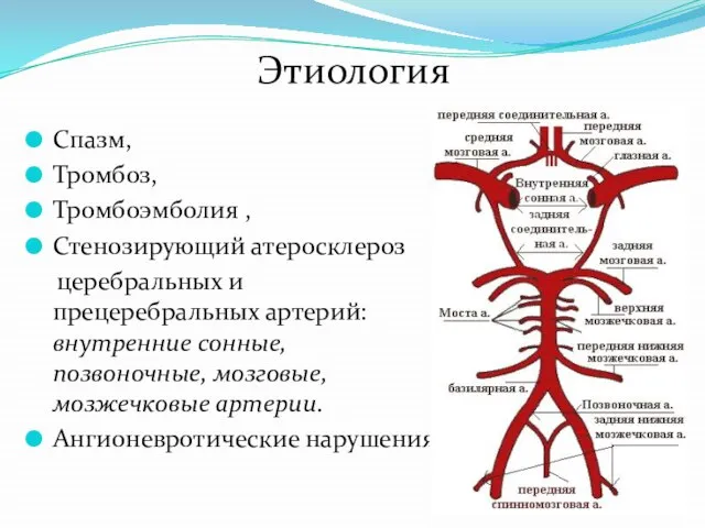 Этиология Спазм, Тромбоз, Тромбоэмболия , Стенозирующий атеросклероз церебральных и прецеребральных артерий: внутренние