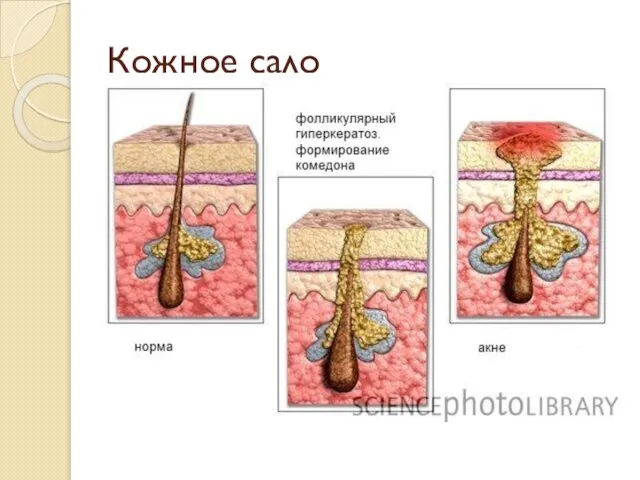 Кожное сало