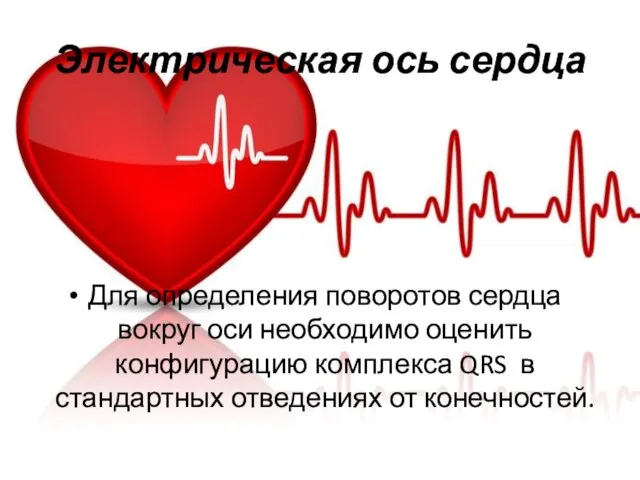 Электрическая ось сердца Для определения поворотов сердца вокруг оси необходимо оценить конфигурацию