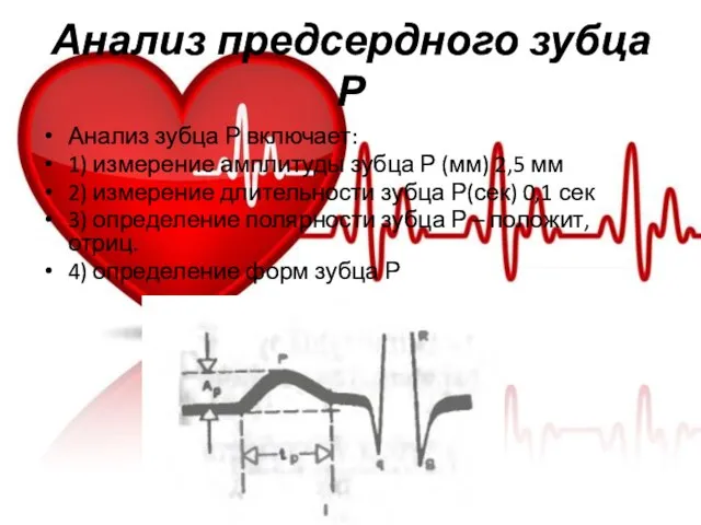 Анализ предсердного зубца Р Анализ зубца Р включает: 1) измерение амплитуды зубца