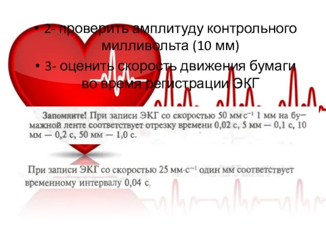 2- проверить амплитуду контрольного милливольта (10 мм) 3- оценить скорость движения бумаги во время регистрации ЭКГ