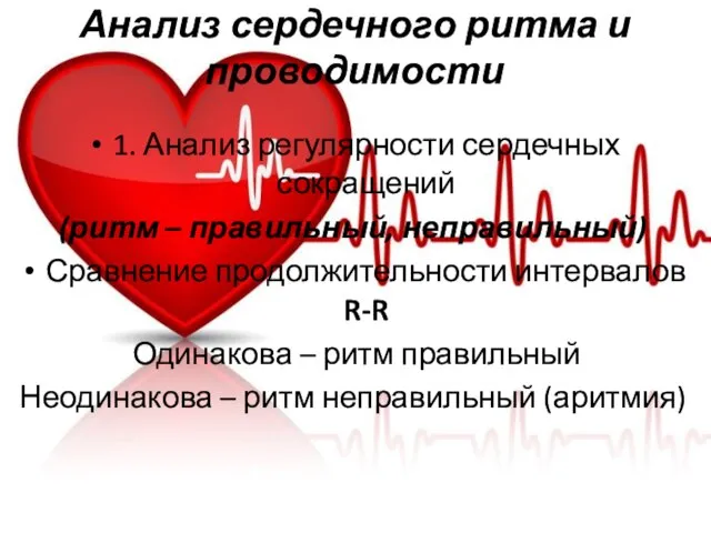 Анализ сердечного ритма и проводимости 1. Анализ регулярности сердечных сокращений (ритм –
