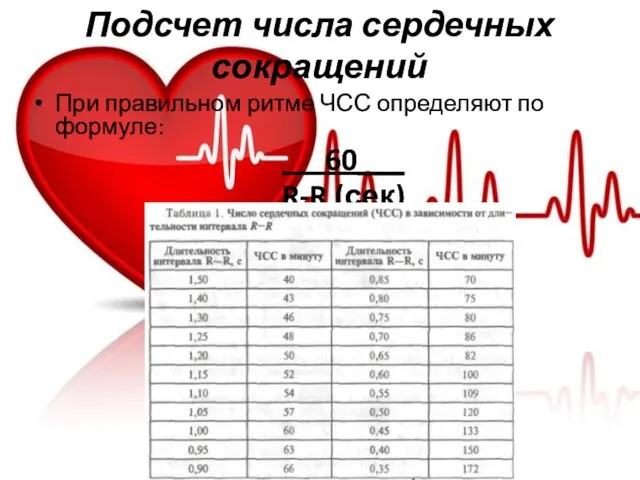 Подсчет числа сердечных сокращений При правильном ритме ЧСС определяют по формуле: 60___ R-R (сек)