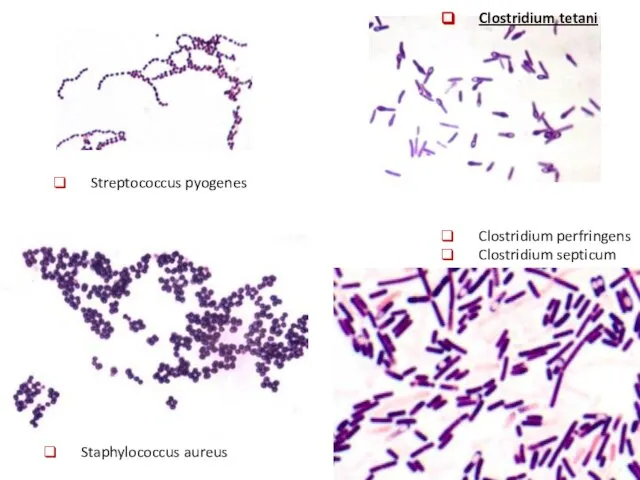 Streptococcus pyogenes Staphylococcus aureus Clostridium tetani Clostridium perfringens Clostridium septicum