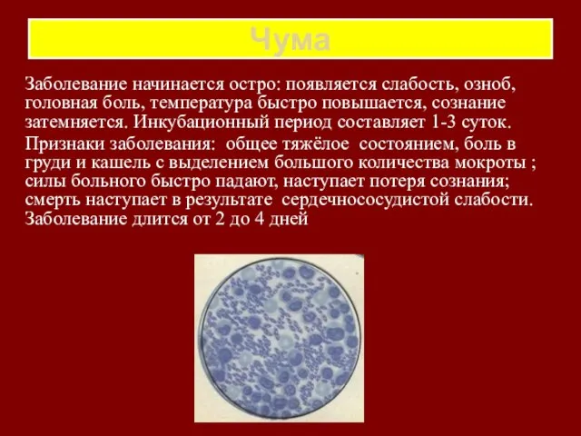 Чума Заболевание начинается остро: появляется слабость, озноб, головная боль, температура быстро повышается,