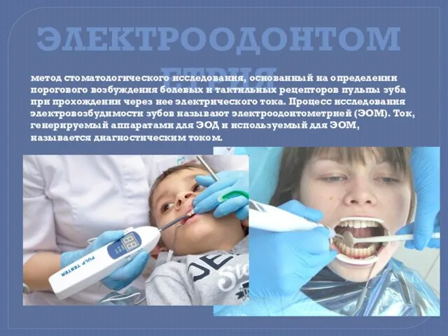 ЭЛЕКТРООДОНТОМЕТРИЯ метод стоматологического исследования, основанный на определении порогового возбуждения болевых и тактильных