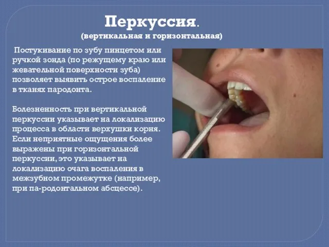 Постукивание по зубу пинцетом или ручкой зонда (по режущему краю или жевательной